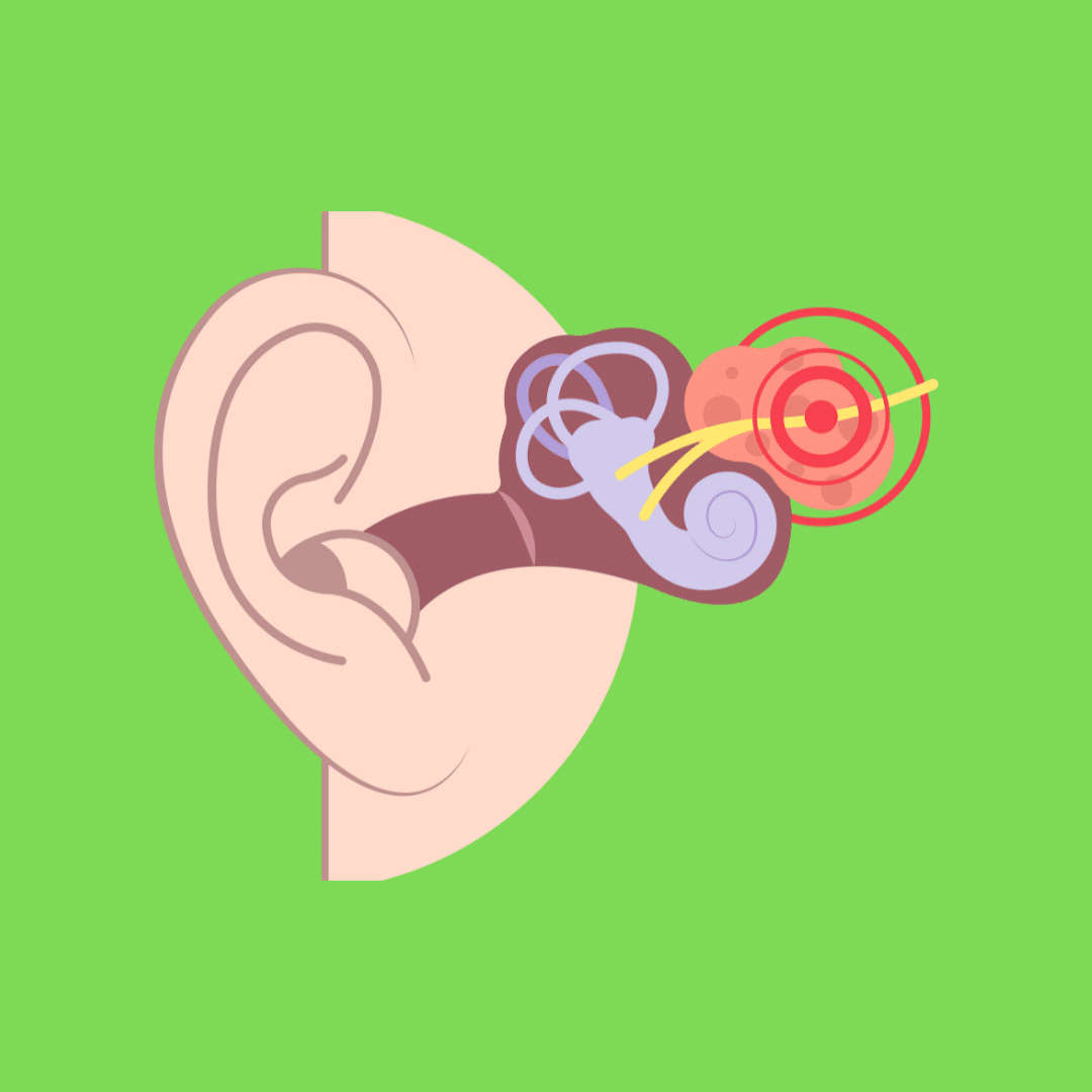 Vestibular Injury Claims for Compensation - Beacon Law